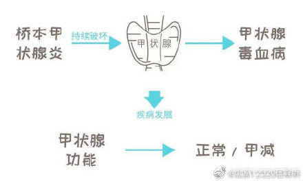 甲状腺激素|桥本氏甲状腺炎患者的饮食调理应注意