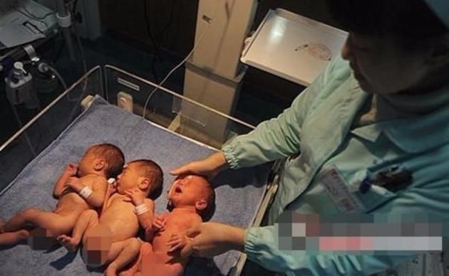 二胎政策|52岁产妇生出“三胞胎”，看到娃后却崩溃大哭，医生有点尴尬