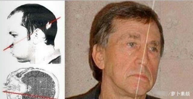 当他把头伸进粒子加速器时，他被高能质子束直接击中