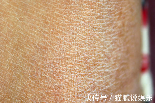 脚部|血糖超标时,双脚先知道?脚上出现异常现象,警惕糖尿病足到来