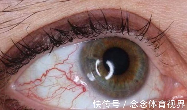 黄曲霉毒素|身体两部位“发痒”,别误为是过敏,或是癌细胞到来征兆