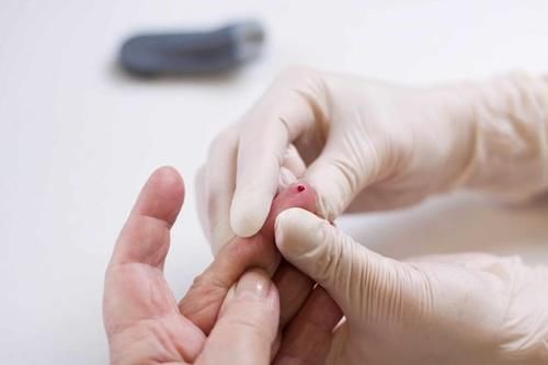 患上糖尿病|糖尿病患者,不想血糖“失控”,这4类食物再喜欢,也要忌口!