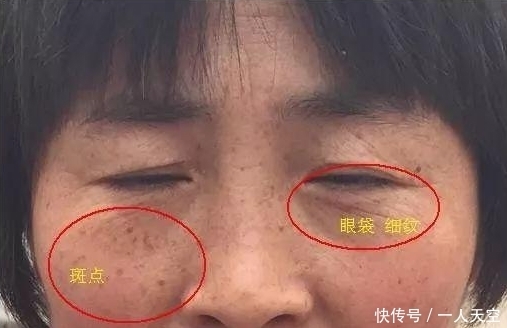 常喝的它,大娘用来敷脸。20天祛斑比女儿还年轻
