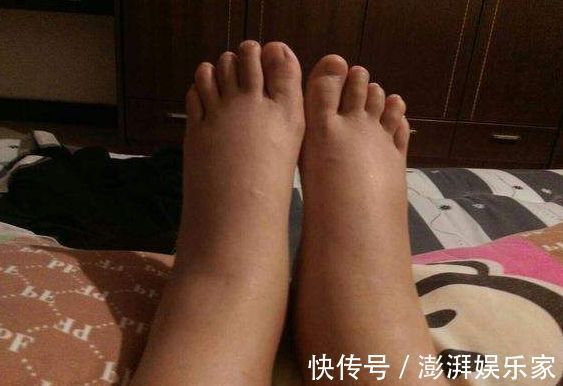 脚背|血管堵,脚先知,若脚上没有4种情况,恭喜,血管依旧“年轻”