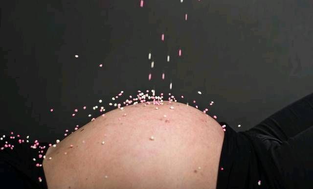 胎记|宝宝出生时脸上有胎记胎记是如何形成的注意怀孕