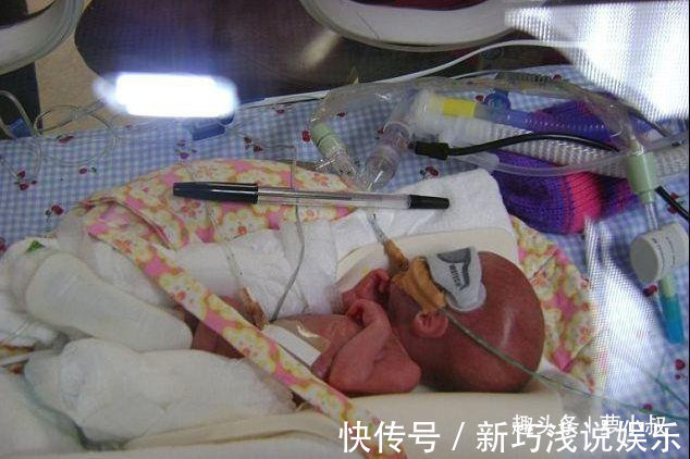 宝宝|14年前那个世上最小婴儿,看到如今颜值后,真令人羡慕!