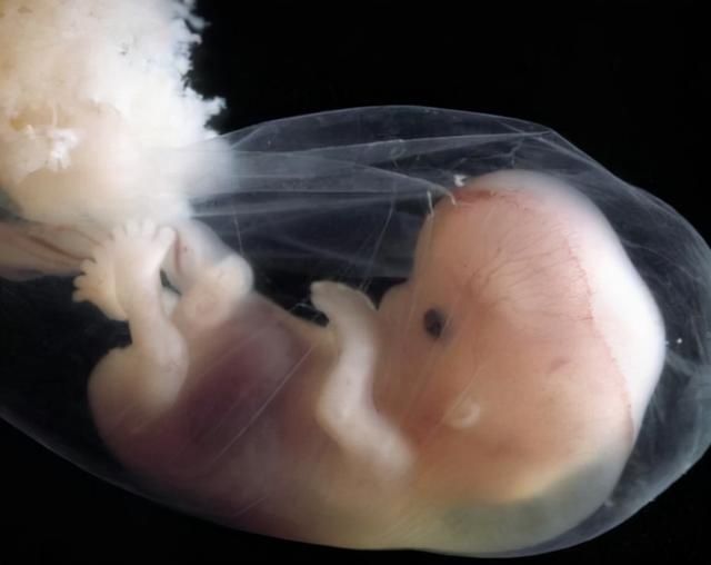 黑白榜|这几周是胎儿畸形高峰期，孕妇看看这份“黑白榜”，别嘴馋害胎儿