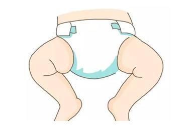 宝宝|尿不湿会导致红屁股?儿科医生:只要记住这3点,就没问题