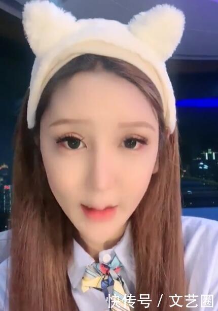 女網紅整容失敗後坦言很後悔 腳後跟都打過玻尿酸 現在心理已經病態 中國熱點