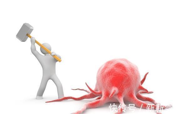 治愈|癌症能不能治愈？肿瘤专家：满足这三个条件，就可以