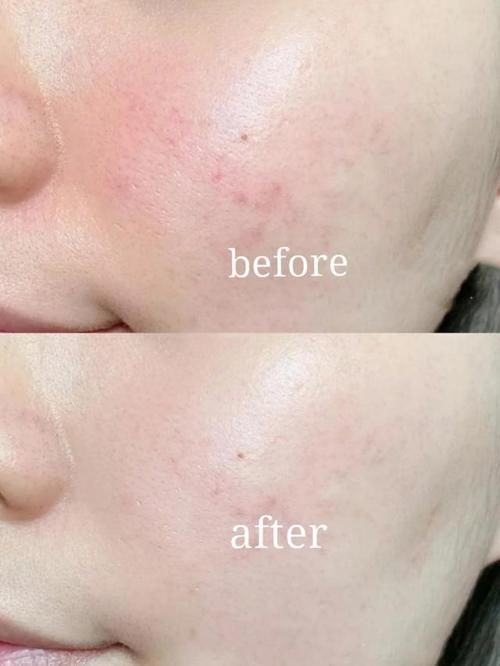 一孕老十年？亲测孕妈安全护肤合集，孕妈轻松逆袭，做冻龄女神