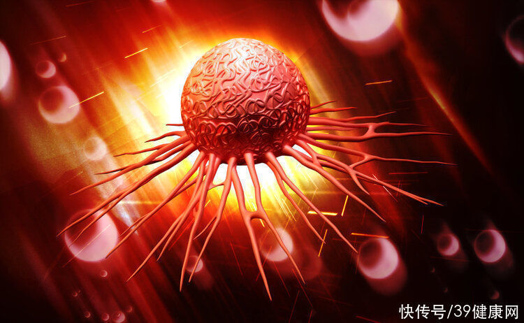 损伤|全球首创!中国专家用高温“烫”死癌细胞,治疗多种肿瘤,损伤小