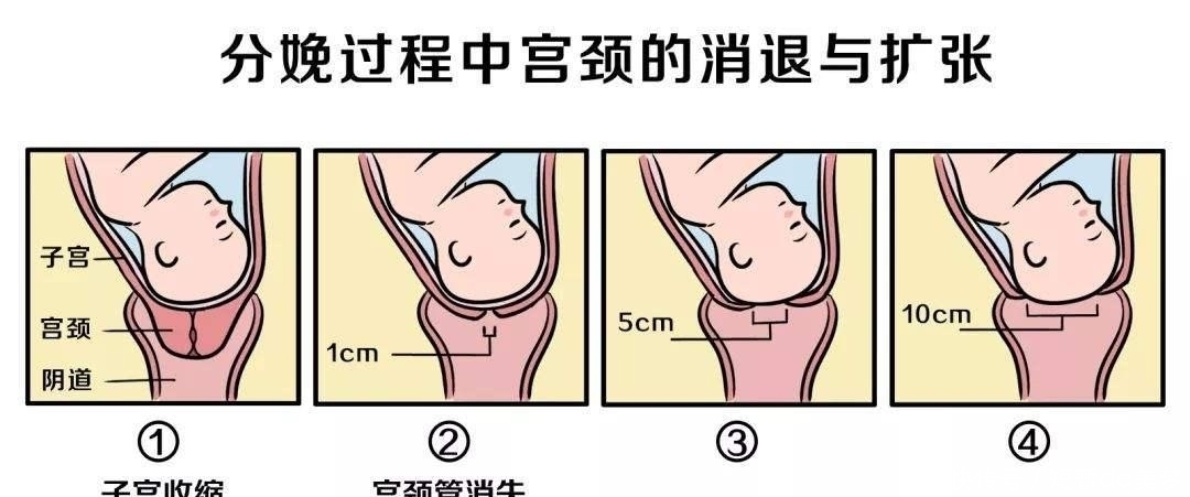 顺产|孕37周双顶径9.9厘米，还能顺吗？想要顺产的准妈妈一定要看