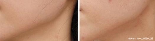 被国人逼上绝路!屈臣氏38元“贱卖”兰蔻粉水,这下雅诗兰黛慌了!