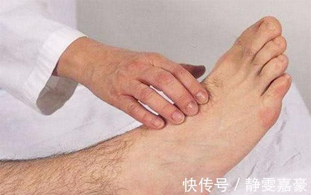 甲状腺功能减退|脚部有“4症状”,是“大病”在提前通知你,医生需尽早就医