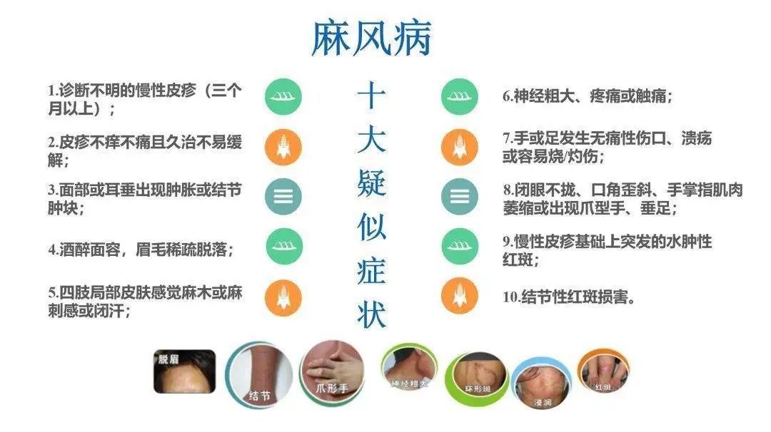 疾控中心|您了解麻风病吗？