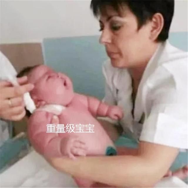 丈夫|500多斤产妇顺利分娩,可孩子出生后,丈夫和医护人员都心情复杂