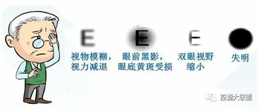 就医|糖尿病人出现这7个信号,说明血糖失控恶化了