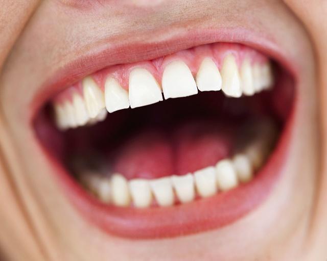 刺激|怎么养胃最全面的养胃方法,值得大家收藏