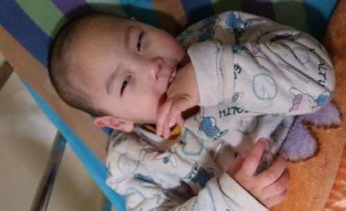 mri|如何第一时间发现脑瘫，脑瘫的4个异常