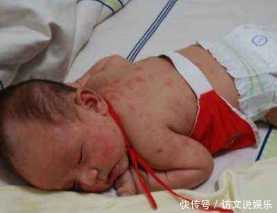 红疹子|老婆带3周孩子游泳,到家后孩子一直哭闹,掀开衣服一看老婆懵了