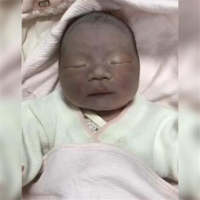 逆袭|“黑脸宝宝”刚出生就被全家嫌丑，两个月后却逆袭成全家“团宠”