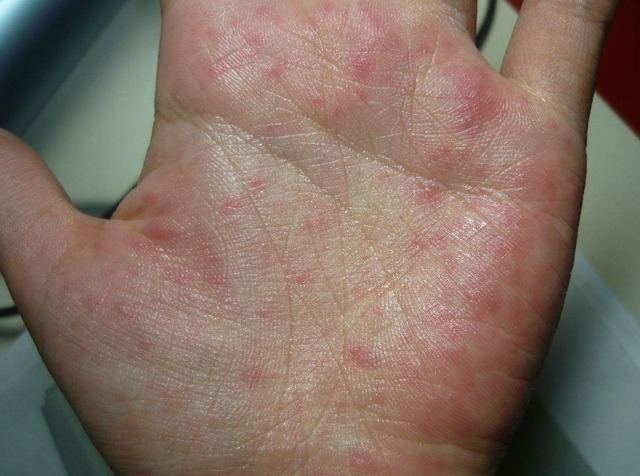 肠胃|消化科医生养胃很简单，3种“零食”，你若爱吃，胃自然好起来