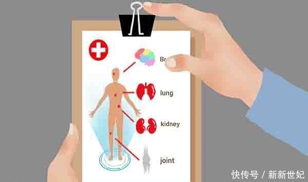 体检时,4个检查项目,医生建议别省掉,别给癌症“留门”