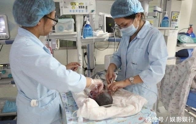 医生|孕妇生下宝宝后,孩子却有2条命,医生说出真相后妈妈哑口了!
