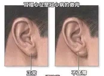 下巴|你能活多久？看一眼脸就知道！长寿脸的10个特征，你占几个？