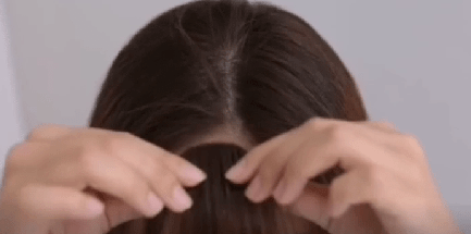 假发|给秃头女孩指条明路吧