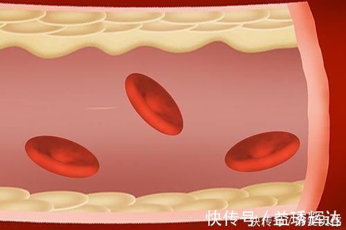 脾气虚|十人九脾虚脾虚命薄，老祖宗留下的健脾妙方，补虚养脾全身轻松