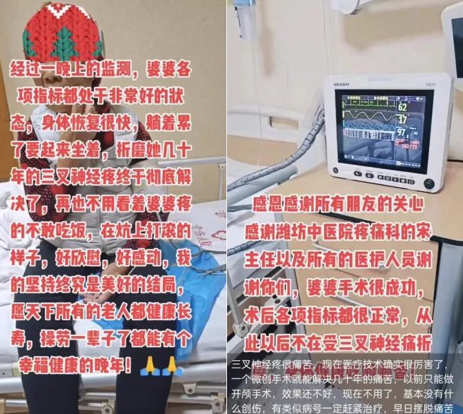 小球囊|小球囊打败三叉神经痛，孝顺儿媳的心愿终于达成了