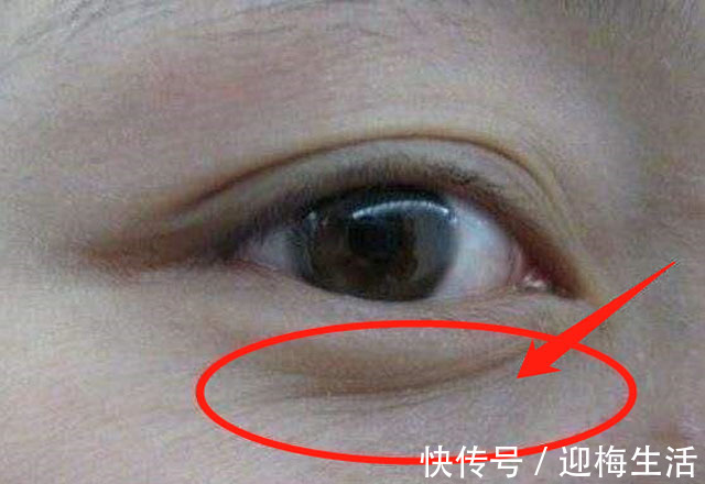 子宫|子宫好不好,看脸就知道脸若有4个不良现象,要注意保养子宫