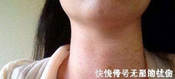 食物|患甲状腺结节的女性,常吃5种食物,守住2个原则,有助消肿散结!