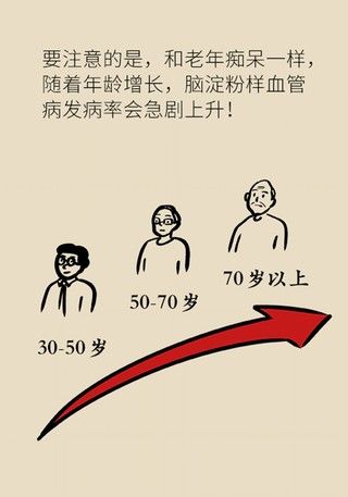 瞌睡|记性变差容易瞌睡，有可能是这种脑出血