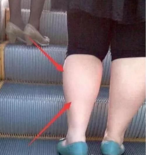 节食减肥|早上空腹“禁止”吃3物，相当于喝油，怪不得“大象腿”一直在