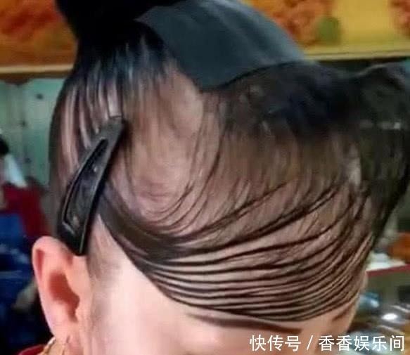 戴假发|大妈花4万多植发,新发型让人哭笑不得,网友:还是戴假发吧!