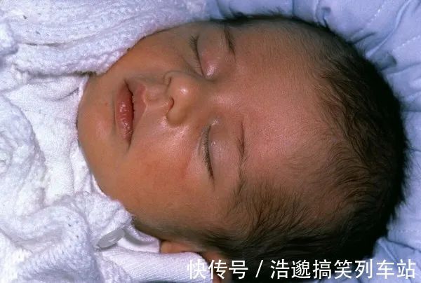 孕妈|不想宝宝出生后被黄疸“找上门”,孕期孕妈坚持“三不做”很关键