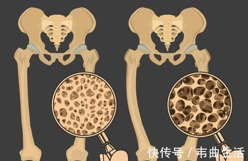 身体|女人绝经后，身体出现3种表现，警惕骨质疏松找已上门，需重视