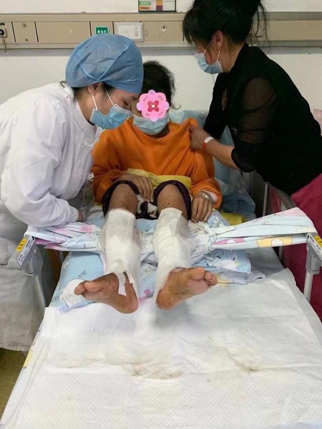 13岁少女双下肢严重溃烂险些截肢,同济儿科