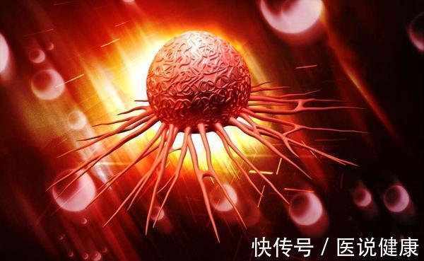 胃部|胃癌患者,除了治疗,这5个措施也要重视,才能事半功倍