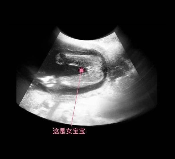 性别|胎儿从卵泡到性别形成,17张图片清晰诠释,男宝女宝看得很清楚