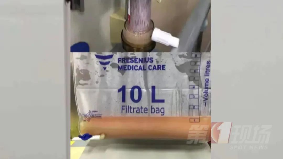 肾内科|男子三次血浆大置换，只因这个不良生活习惯……医生紧急提醒