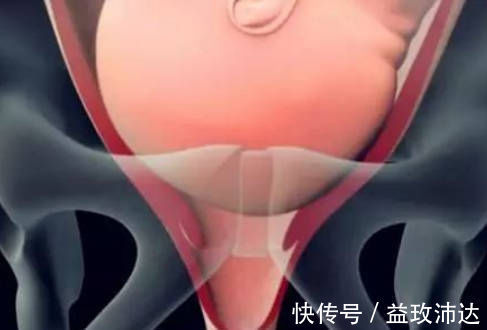 子宫|产房分娩的过程是啥?实拍图还原顺产过程,看完明白为母则刚