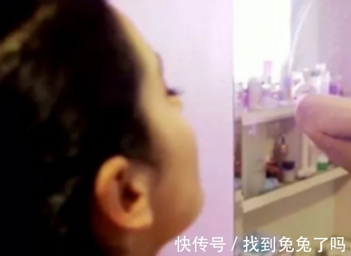 铁圈|女子套五公斤铁圈，五年来不堪其扰，结果怎么样了？