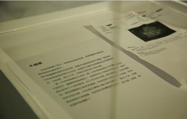 胎儿|“胎心151,后壁,双肾未分离”,医生夸宝宝优秀,暗示啥