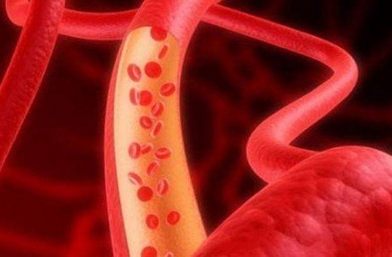 动脉|血管堵没堵,摸一摸5个部位就知道!占两个,要警惕血栓