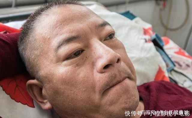 食物|脑梗的“诱因”或被发现,肥肉只能排第四,第一许多人都戒不掉