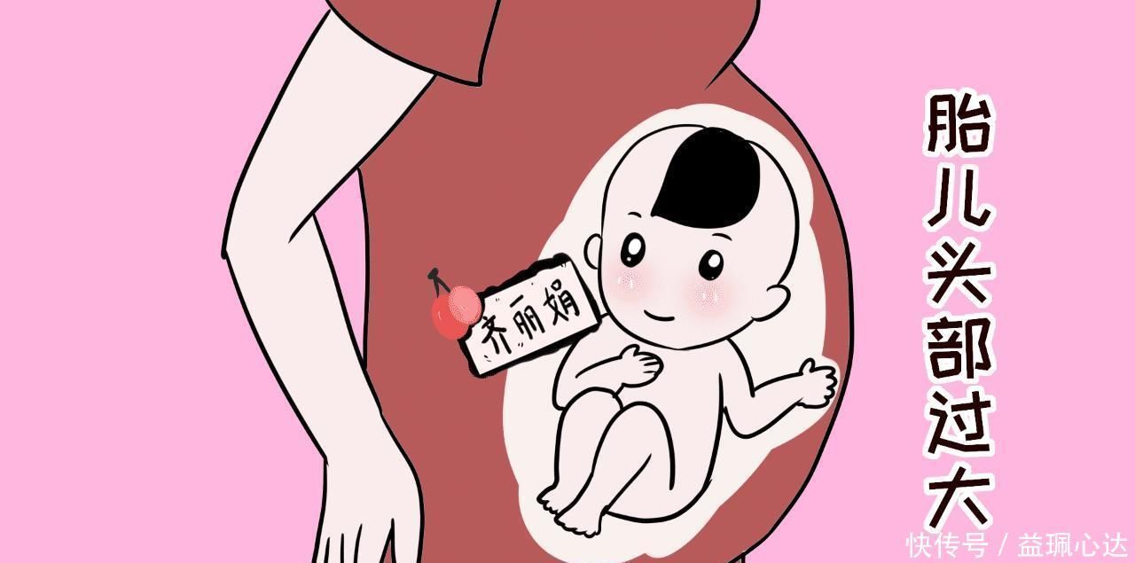 行为|侧切不会影响夫妻行为?你可能被医生骗了,不是所有人都需要侧切